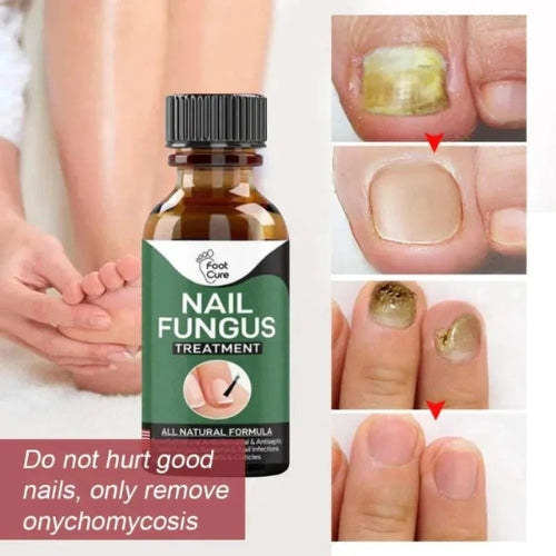 Healthy Nails

